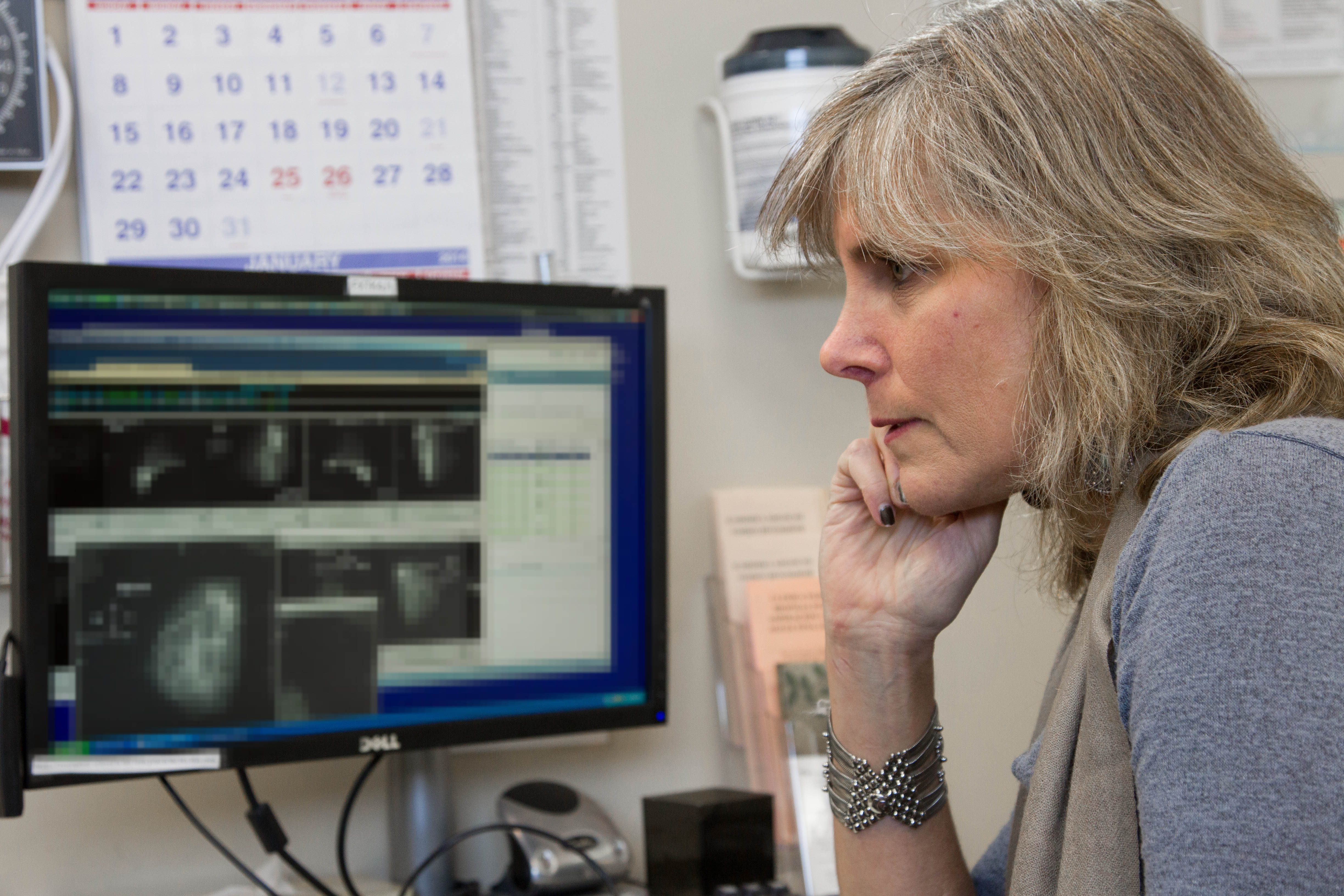 Wisdom Study: Discovering the Best Approach to Breast Cancer Screening