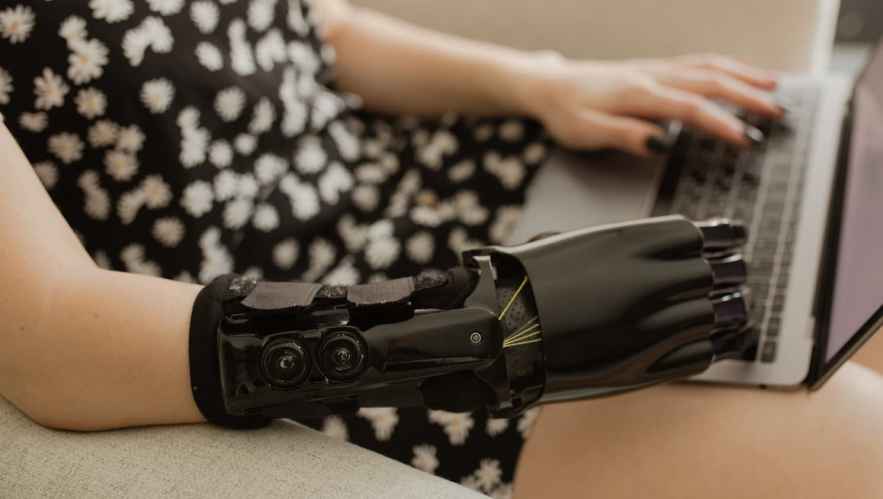 Person with a prosthetic hand using a laptop: ada compliance, web accessibility, a11y