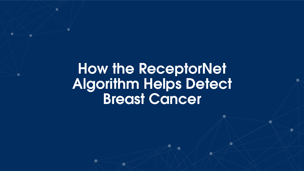 How an AI algorithm helps detect breast cancer