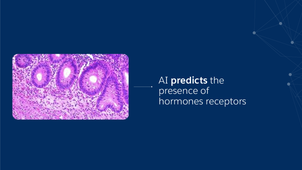 ReceptorNet can predict hormone receptors